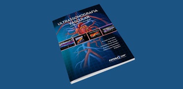 Livro: Ultrassonografia Vascular - Sistematização de Exames