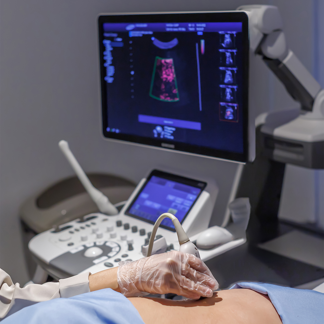 Básico de Ultrassonografia Em Medicina Interna